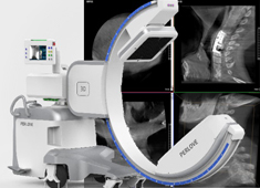 骨科常用的仪器设备介绍：从骨科C臂X光机到骨密度仪