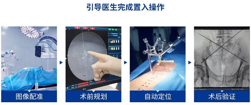 骨科手术机器人标准化流程