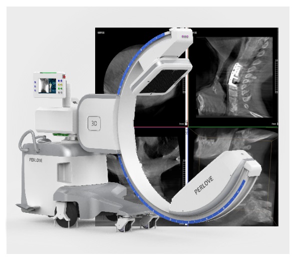 骨科C臂X光机